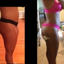 Other side b4 and after