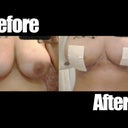 Before and after flick! my boobies are officially small =)