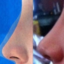 3D Consultation Picture Compared to Week 2 Results