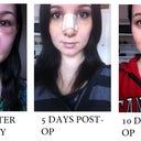 Transformation from the FRONT