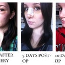 Transformation from the LEFT 3/4