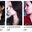 Transformation from the LEFT PROFILE