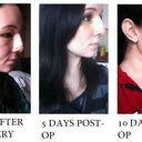 Transformation from the RIGHT PROFILE