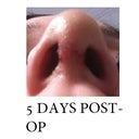 Nostrils