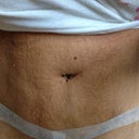 2 weeks po. My stomach has towel imprints on it from sleeping in my binder.
