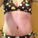 BIKINI!!!! 4 weeks post op