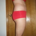 2 days post-op