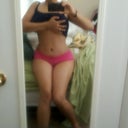 3 months after my surgery