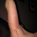 left arm