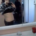 After photo post 8 weeks after procedure.