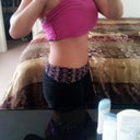 Side view (1 yr and 5 months post op)