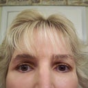 6 week post surgery with make-up