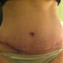 7WPO SWOLLEN