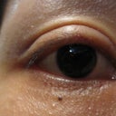 close up pic of my right eye