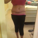 3 Months Post Op- Front View of Incision
