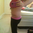 3 Months Post Op- Right Side View of Incision