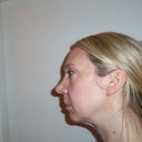 left side