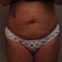Pre-op, 5/26/12