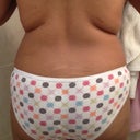 Pre-op, 5/26/12
