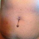 6 months post - NO change from the pre-procedure pics. Sad