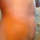 6 month post - NO change front first pics. Disappointing