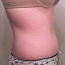 Wk 18-lower bump is ab muscle
