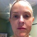 all gunked up pre procedure