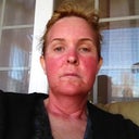 The next day....OUCH!!