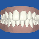 My teeth right now