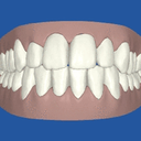 My teeth two years later