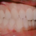 My actual teeth