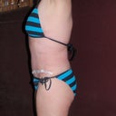 4 weeks post op