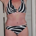 4 weeks post op