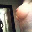 view of left breast from side