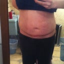 1 wk post, long view. Low belly button.