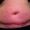 1 wk PO
