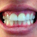 Day 3 of treatment (another look)