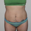 BEFORE: That tattoo is supposed to be a dolphin jumping straight out of water LOL