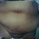 15 minutes before i went in for surgery