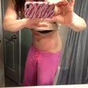 Loose skin