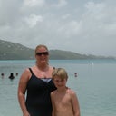 Never a bathing suit pic before weight loss/plastic surgery