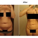 May 2012 - 4 Months Post Op