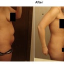 May 2012 - 4 Months Post Op