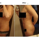 May 2012 - 4 Months Post Op