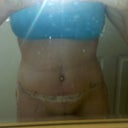 DAY 4 POST OP:Swollen tummy and vj but look at my definition!