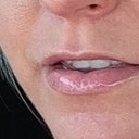 Lips before