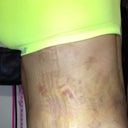 I literally look like I got hit by a bus!