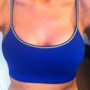 four days post-op