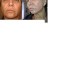 Side by side before and after day 9.