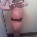 25 days post op